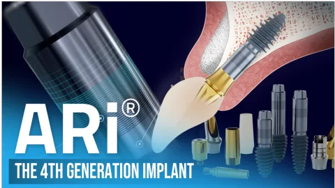 MegaGen Implant Co., Ltd. 产品图 3